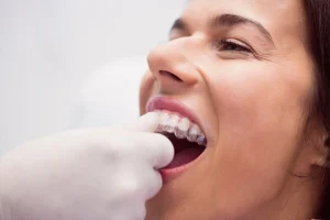 brackets vs ortodoncia invisible