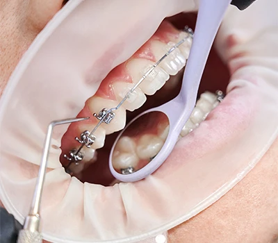 Brackets
