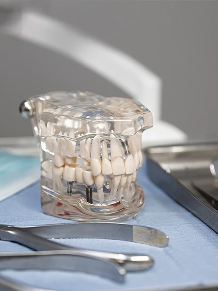 Implante dental